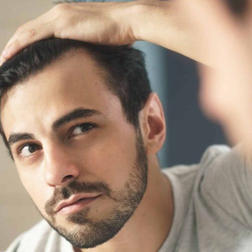 hair-transplant-turkey