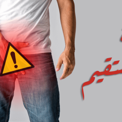 حكة المستقيم ما هي اسباب حكة المستقيم؟